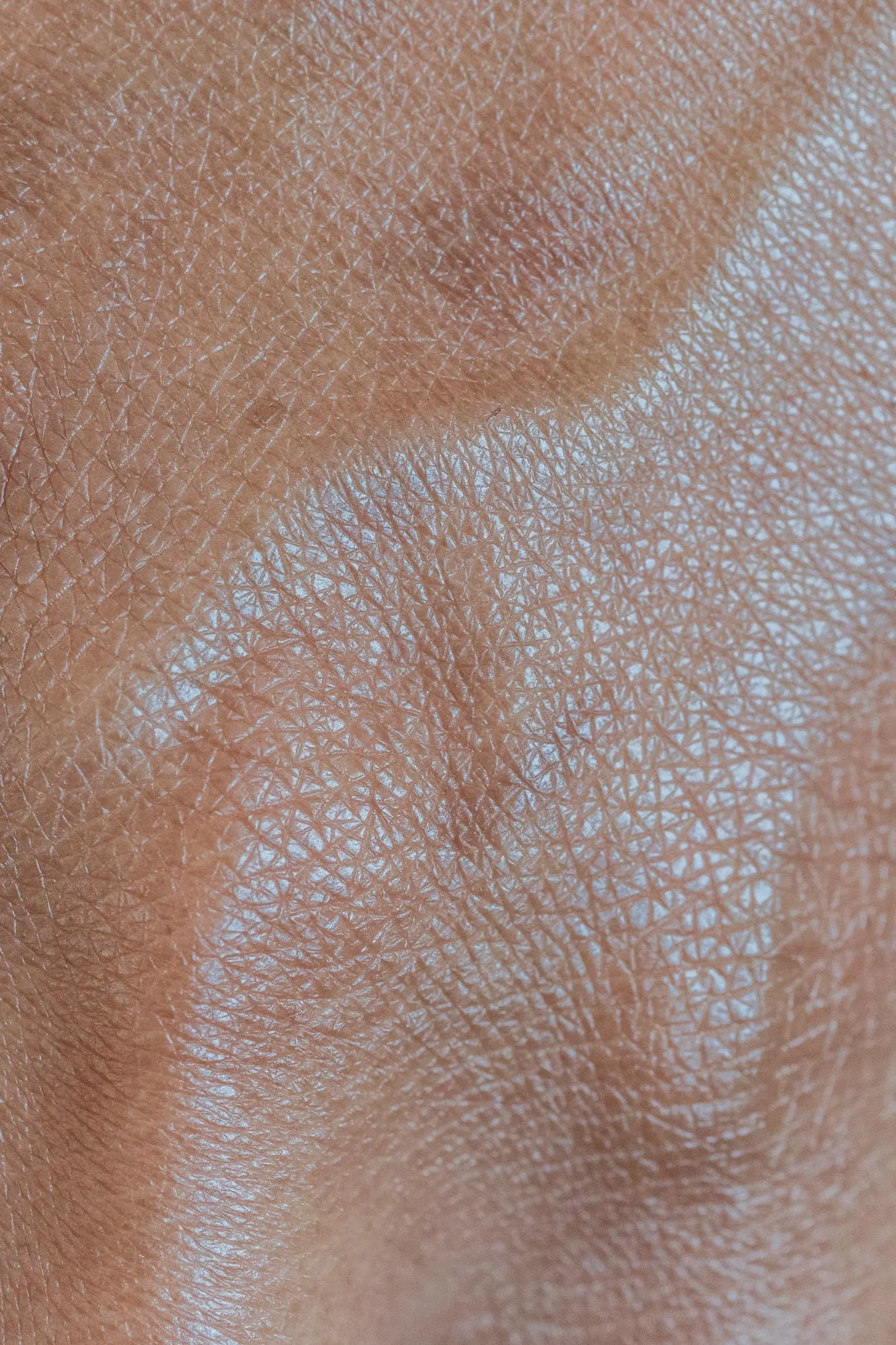 Macrographie d'un pli cutané